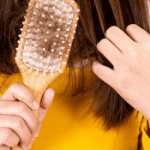 Hair Fall Treatment