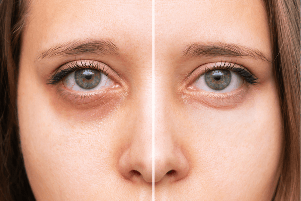 10 Proven Ways on How to Remove Tan from Face Naturally